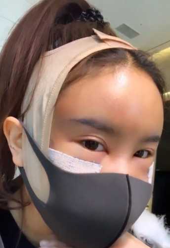 流产后为何会出现面部浮肿-第1张图片