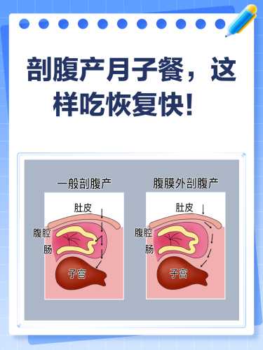剖腹产月子菜谱大全有哪些-第1张图片