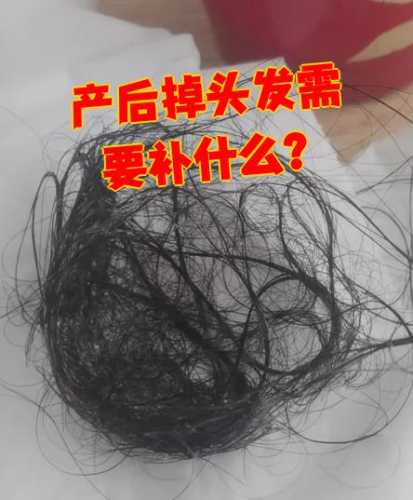 剖腹产后掉头发是怎么回事-第1张图片