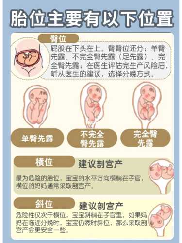 胎教可以调整胎位吗视频-第1张图片