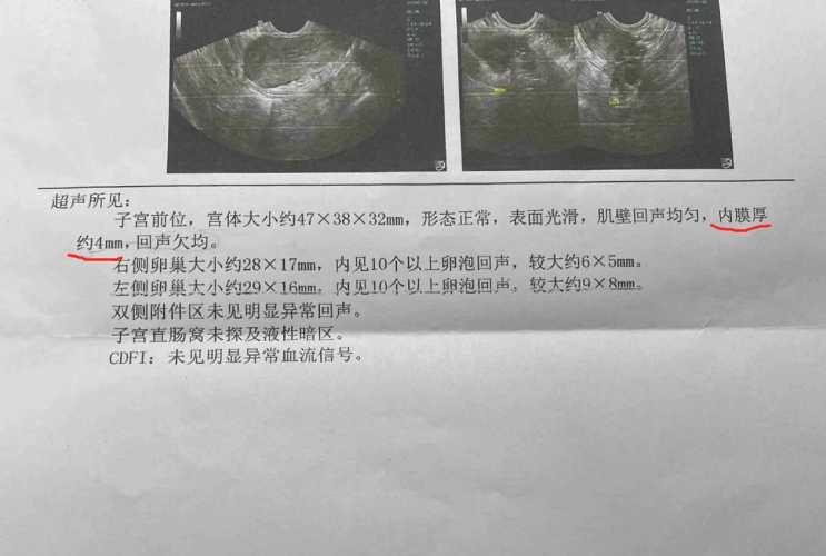 内膜12厚度能否成功怀孕-第1张图片