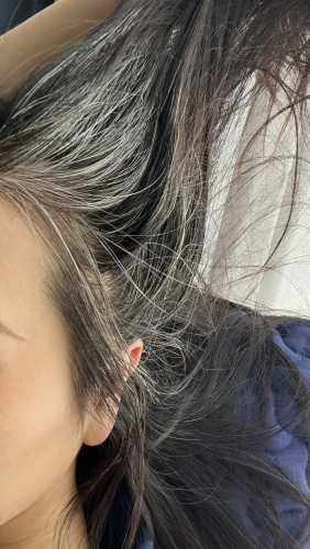 婴儿白发是什么原因-第1张图片