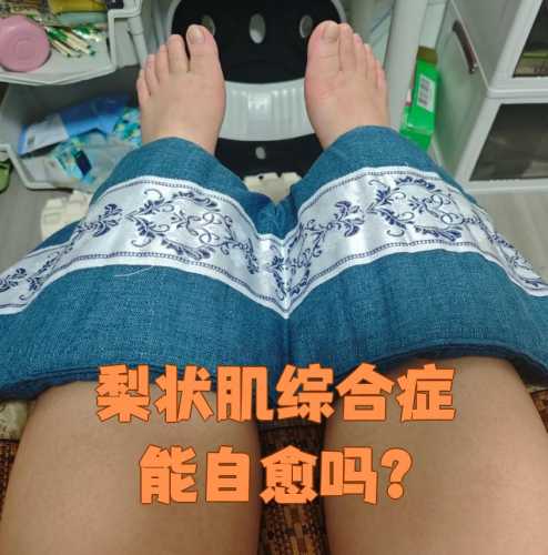 产后梨状肌问题该如何解决-第1张图片