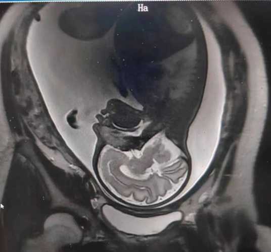 花茵美备孕安全吗-第1张图片