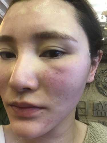 月子里烙下的病根能治好吗-第1张图片