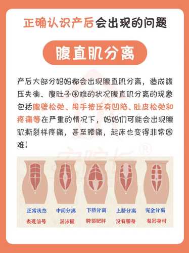 产后康复课件有啥实用要点-第1张图片