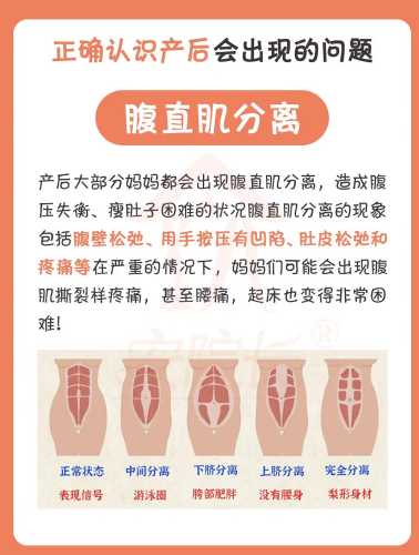 产后如何快速恢复身体状态-第1张图片