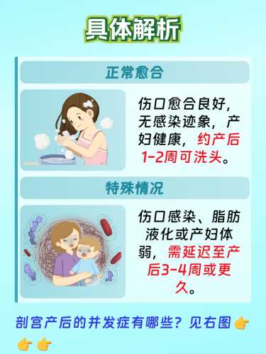 剖腹产怎样才能快速恢复-第1张图片