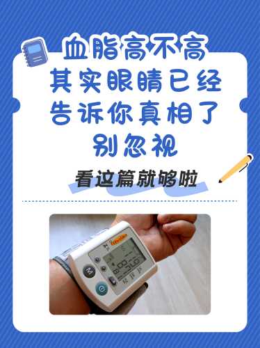 备孕血脂六项检查有哪些-第1张图片