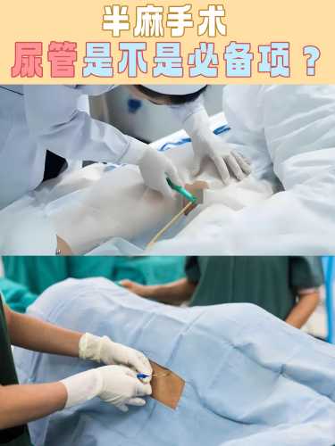 剖腹产可以打全麻吗-第1张图片