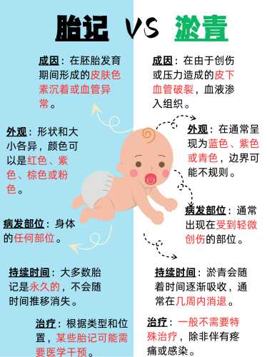 新生儿有红胎记咋办-第1张图片