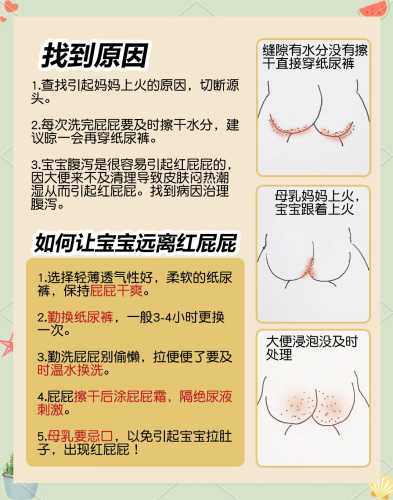 新生儿屁股有个坑是怎么回事-第1张图片