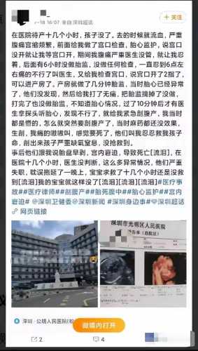 深圳有哪些剖腹产医生-第1张图片