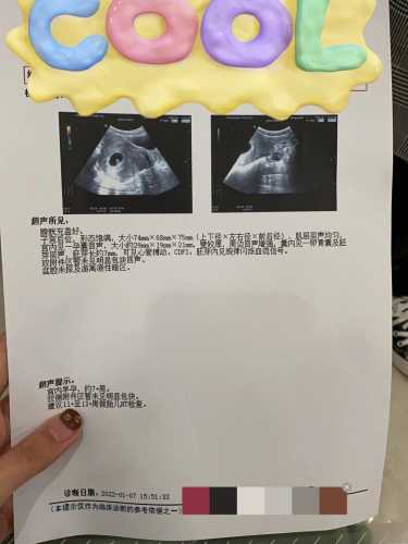 孕十周孕反好转正常吗-第1张图片