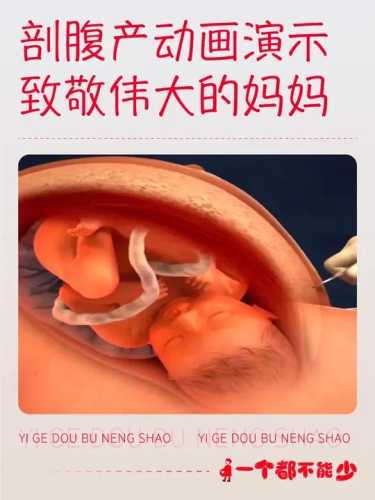 剖腹产为啥一直哭-第1张图片