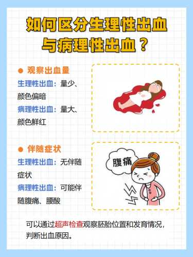 剖腹产产血是怎么回事-第1张图片