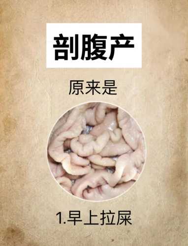 明基医院剖腹产怎么样-第1张图片