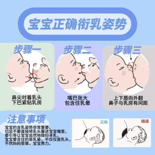 婴儿乳头需不需要挤-第1张图片