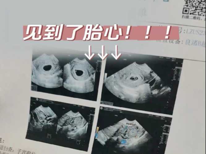 7周后孕反减轻正常吗-第1张图片