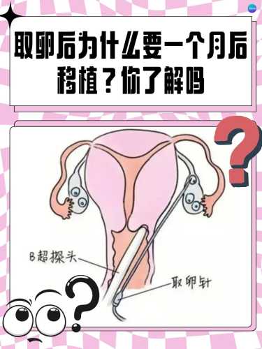 试管婴儿步骤过程图咋看-第1张图片