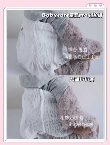 纸尿裤换牌子会有什么影响吗-第1张图片