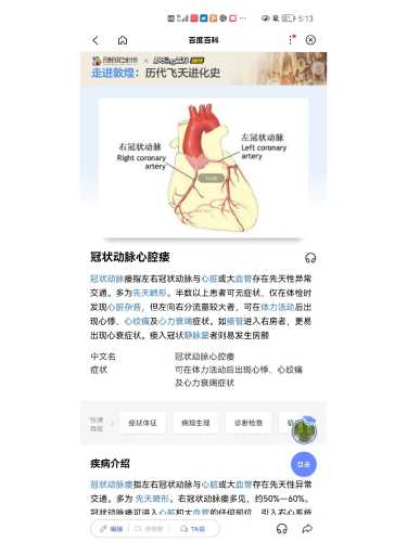 怀孕时能查出先心病吗-第1张图片