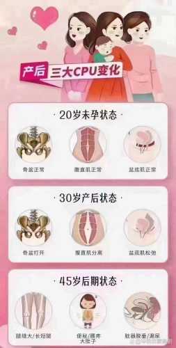 产后修复有必要吗-第1张图片