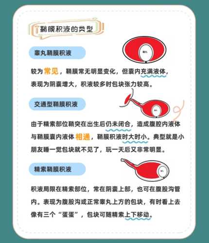 婴儿鞘膜积液怎么治疗-第1张图片