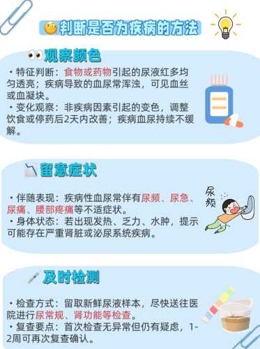 孕反严重验尿有什么不同-第1张图片