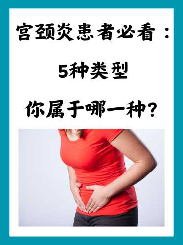 备孕可治疗宫颈炎吗-第1张图片