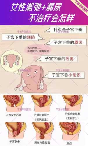 产后三月漏尿怎么办-第1张图片