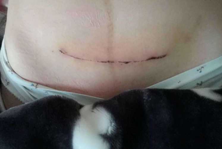 伦敦私立医院剖腹产如何-第1张图片