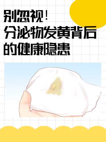 产后四个月白带发黄咋回事-第1张图片
