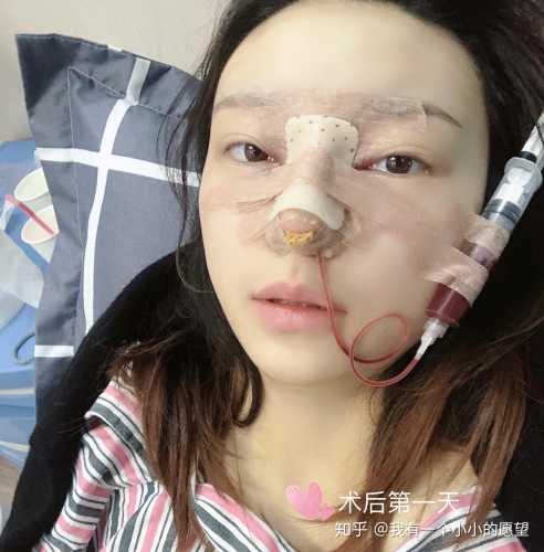 肋骨拍x片影响备孕吗-第1张图片