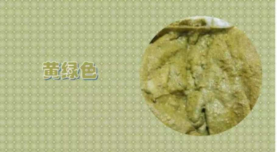 新生儿大便有点绿正常吗-第1张图片