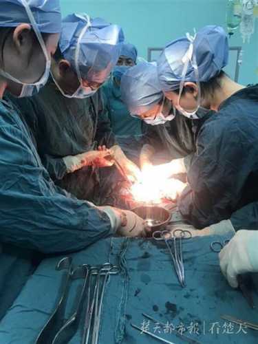 二胎剖腹产大出血概率是多少-第1张图片