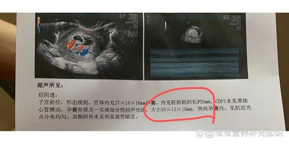 流产后几天需复查？-第1张图片