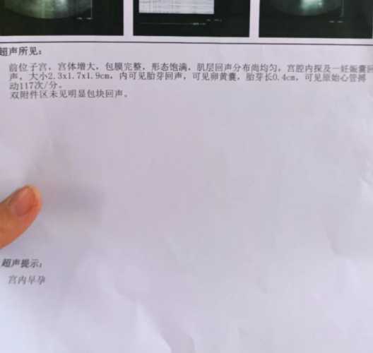 怀孕7周能不能进行药流-第1张图片