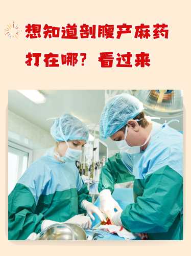 剖腹产麻药打针疼吗-第1张图片