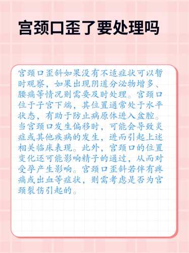 备孕为何要做宫颈筛查-第1张图片