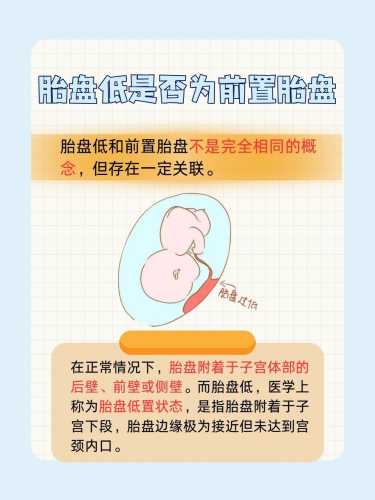 胎盘植入能顺产吗-第1张图片