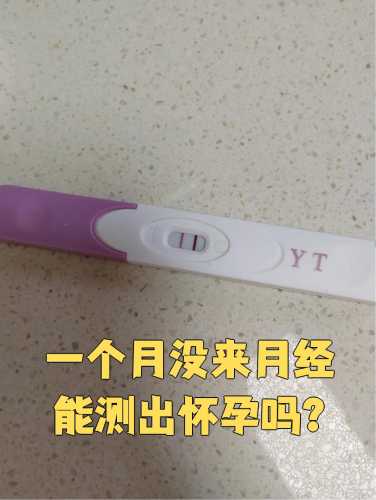 怀孕十天医院能测出吗-第1张图片