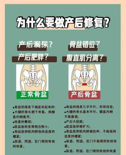 产后产道恢复有哪些要点-第1张图片