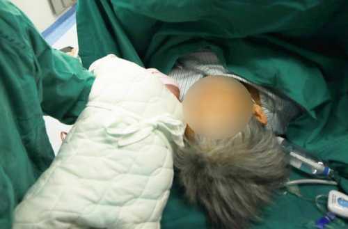 眉山剖腹产情况如何-第1张图片