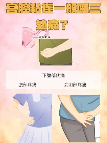 剖腹产后同房疼痛是怎么回事-第1张图片