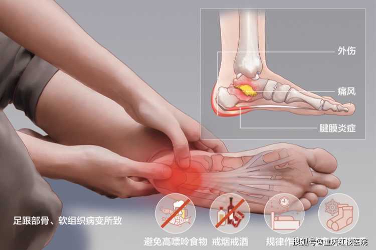月子病脚后跟疼怎么办-第1张图片