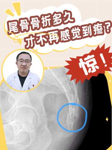 产后尾股疼是怎么回事-第1张图片
