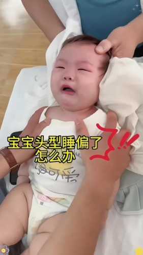 婴儿头睡偏了还能纠正过来吗-第1张图片