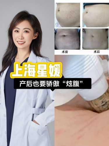 产后如何去除妊娠纹-第1张图片