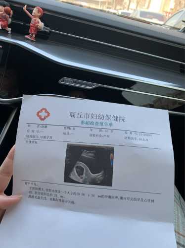 孕10周孕反基本消失正常吗-第1张图片